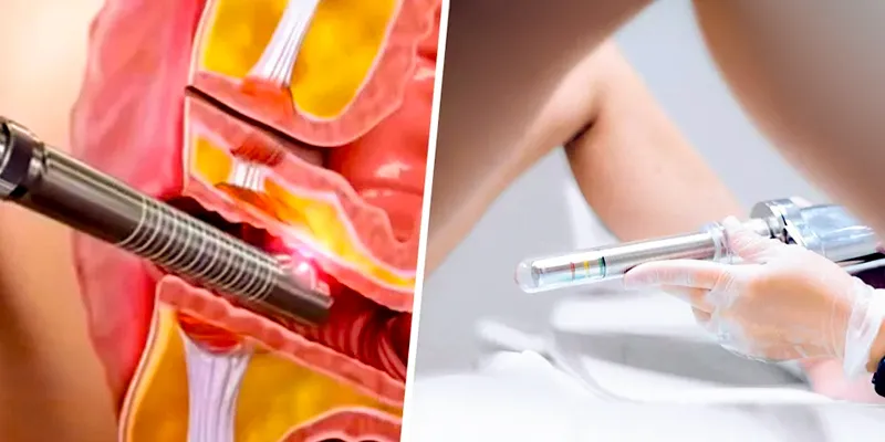 Có Nên Làm Hồng Vùng Kín Không? 4 Laser Làm Hồng Vùng Kín