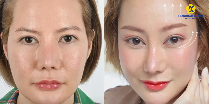Đuôi mắt hướng xuống là tốt hay xấu? 3 cách lấy lại "linh hồn" cho đuôi mắt xệ 6 Cách khắc phục đuôi mắt xệ