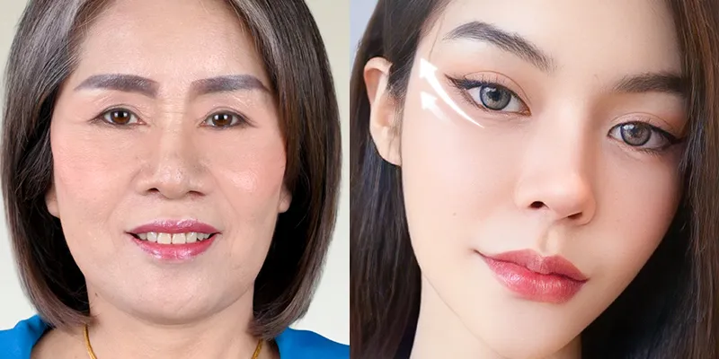 Căng chỉ mắt cáo là gì? Sở hữu đôi mắt sắc sảo không cần phẫu thuật chỉ trong chớp mắt 5 so sanh cang chi mat cao