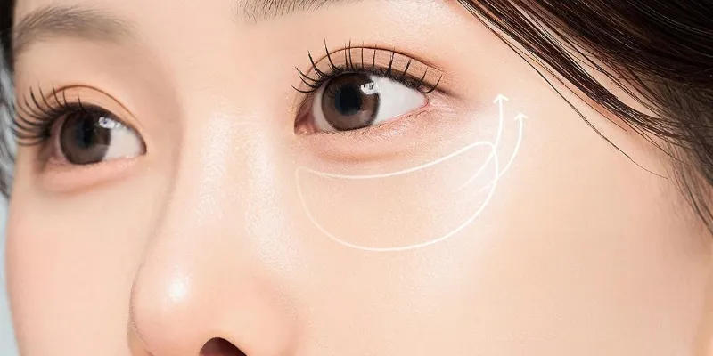 10 cách xóa quầng thâm mắt hiệu quả tại nhà & cơ sở thẩm mỹ 1 cách xóa quầng thâm mắt