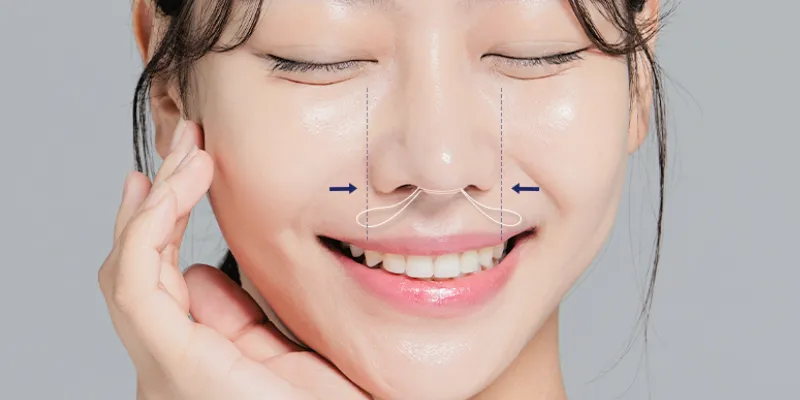 Cuộn cánh mũi bao lâu thì lành? Lịch trình hồi phục chi tiết theo ngày 1 cuộn cánh mũi bao lâu thì lành