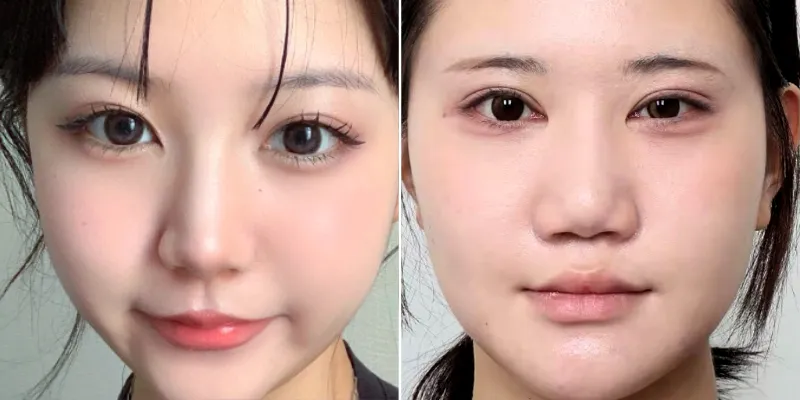 Con gái mũi to thì sao? Tướng số nhân tướng học và cách khắc phục 3 Con gái mũi to thì sao