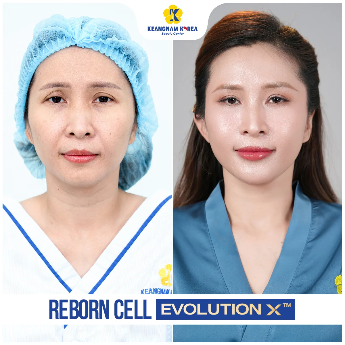 1200x1200_RBE_Web2026_Ngoc-Lien