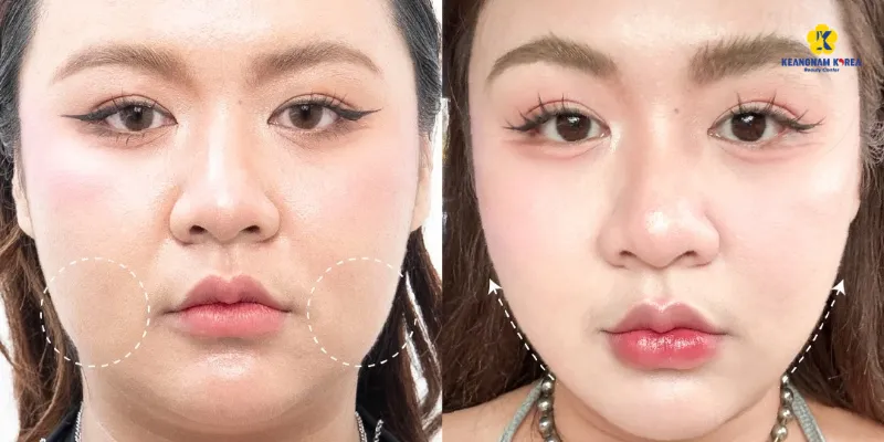 7 dấu hiệu lão hóa da phổ biến: Cách nhận biết và khắc phục sớm 7 7 dau hieu lao hoa da 3