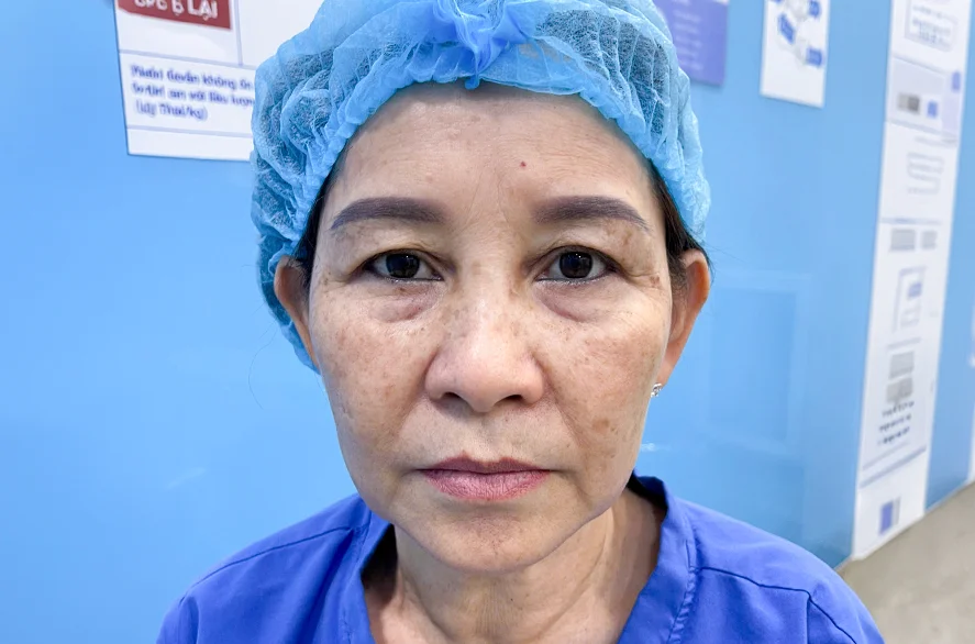 Trước