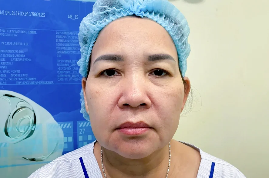 Trước