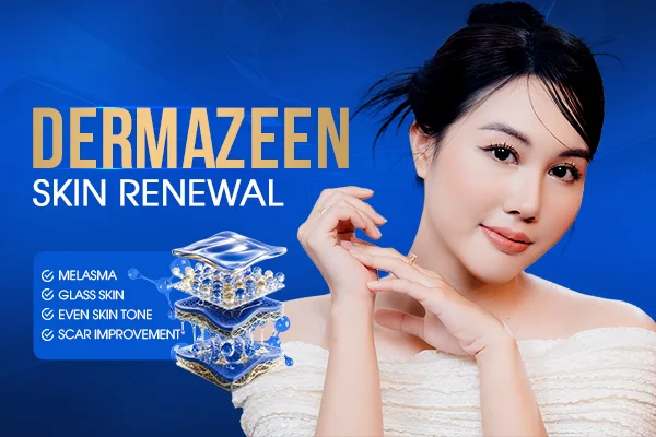 melasma removal