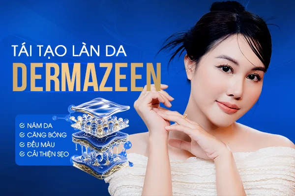 Điều trị nám da