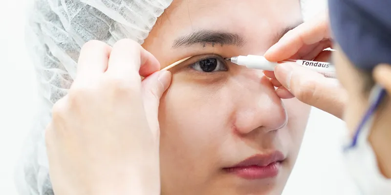 Nâng cung mày ở đâu đẹp? Top 5 địa chỉ uy tín, an toàn tại TP Hồ Chí Minh 4 Nâng cung mày ở đâu đẹp