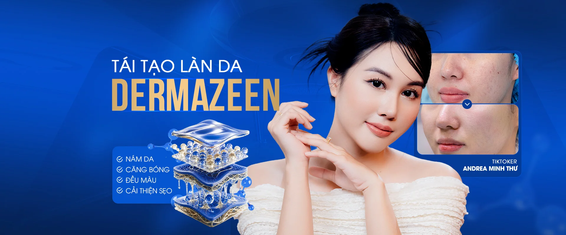 Điều trị nám