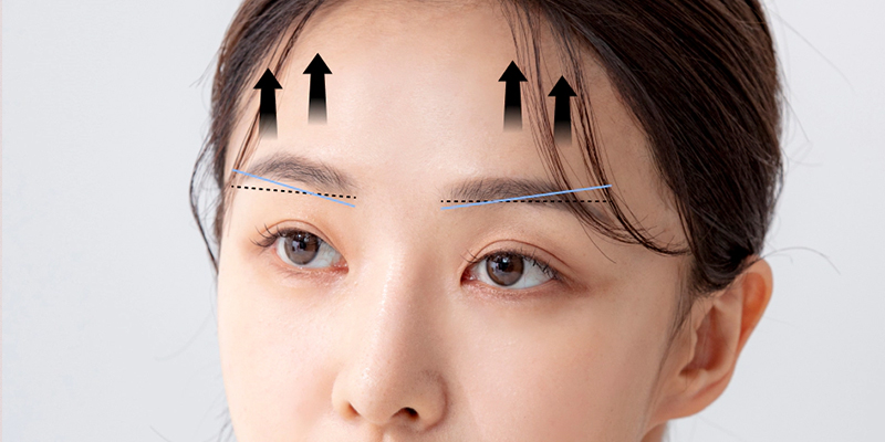 Bao nhiêu tuổi thì nâng cung mày là lựa chọn tốt nhất?