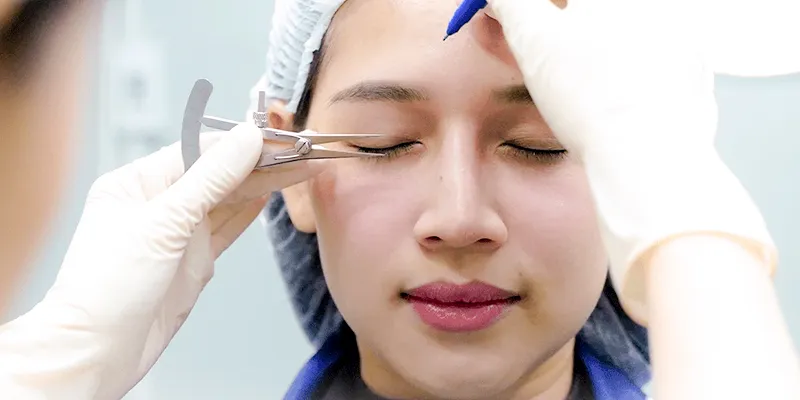Bao nhiêu tuổi thì nâng cung mày là lựa chọn tốt nhất? 4 Bao nhiêu tuổi thì nâng cung mày là lựa chọn tốt nhất?