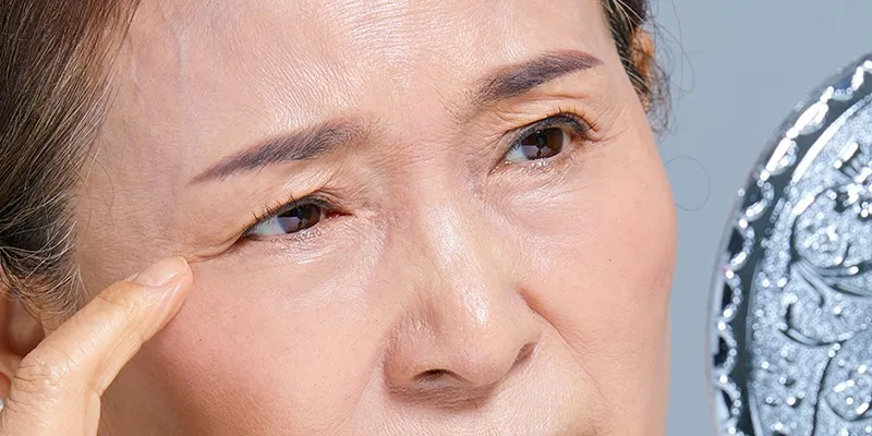 Brow Lift Cost in Vietnam 3 Brow Lift Cost in Vietnam