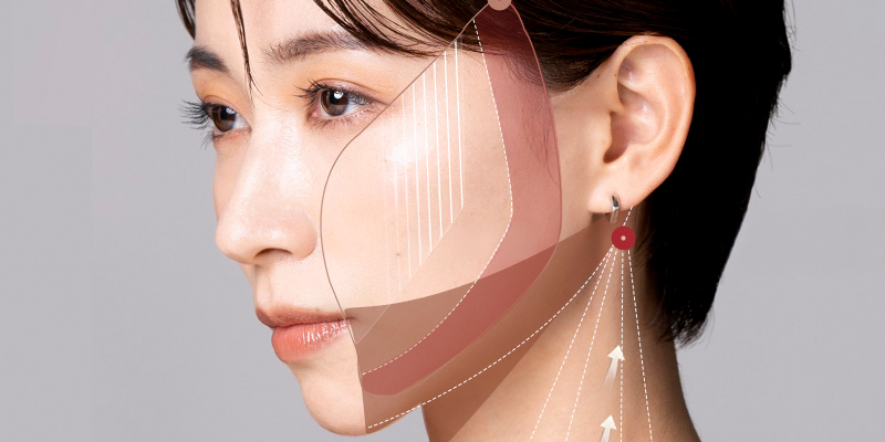 Căng da mặt SMAS là gì? Giá bao nhiêu? Ở đâu tốt? 1 Căng da mặt SMAS là gì?
