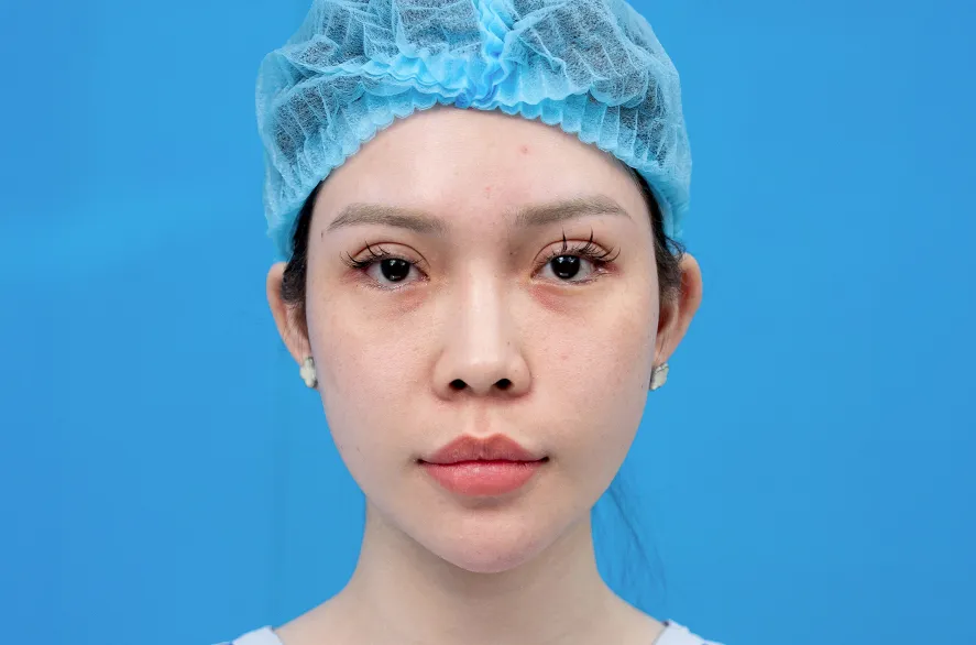 Trước