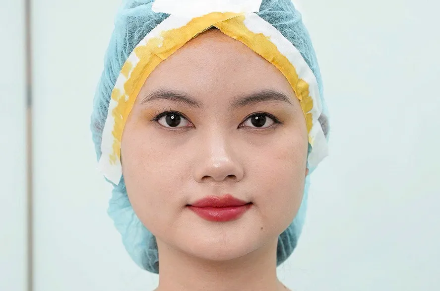 Trước