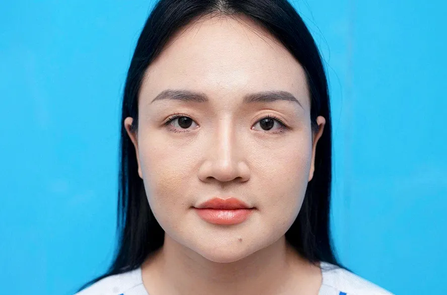 Trước