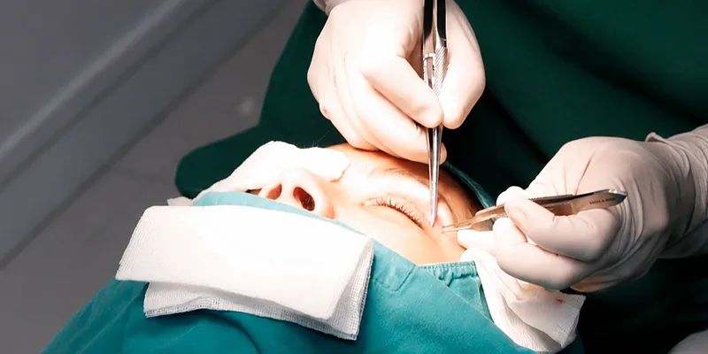 Mí sụp nên cắt mí hay nâng cung mày? Đâu là phương pháp phù hợp hơn với tình trạng của bạn? 6 Mí sụp nên cắt mí hay nâng cung mày