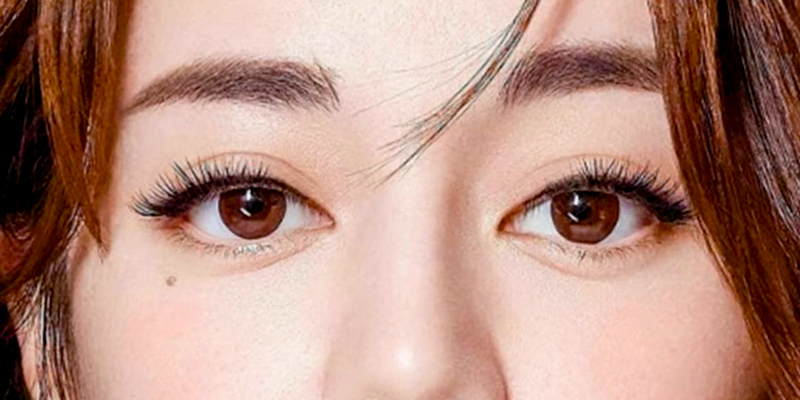Medial Epicanthoplasty: What Is the Chinese Teardrop Eye Trend and Who Suits It? 1 Medial Epicanthoplasty