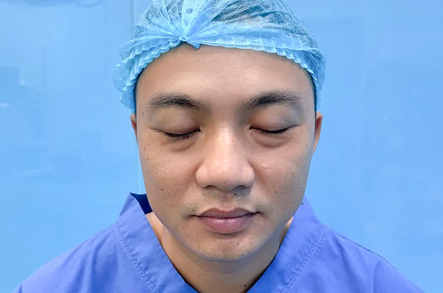 Trước