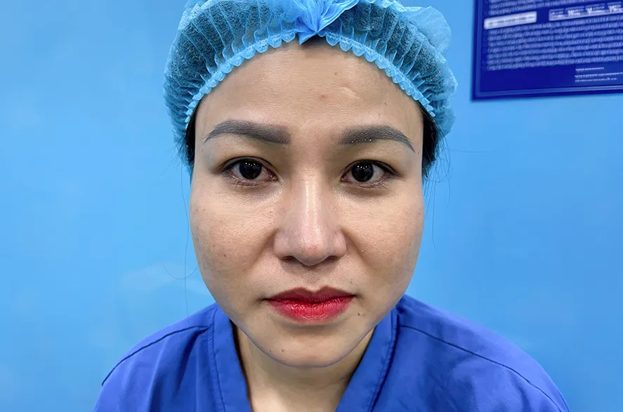 Trước