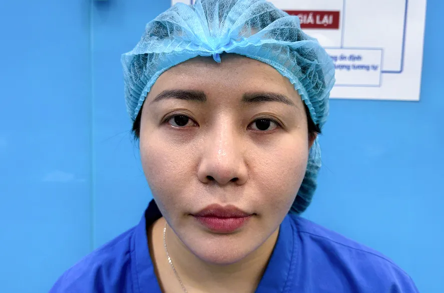Trước