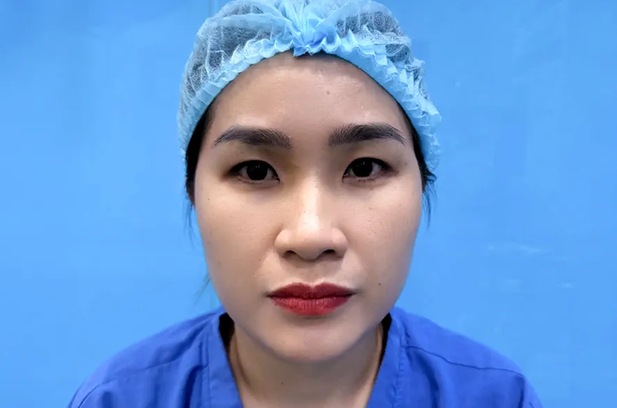 Trước
