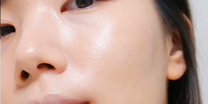 Tiêm meso phục hồi da sau bao lâu thì có kết quả? Đặc trị các trường hợp nào? Giá bao nhiêu? 2 Tiêm meso phục hồi da sau bao lâu thì có kết quả