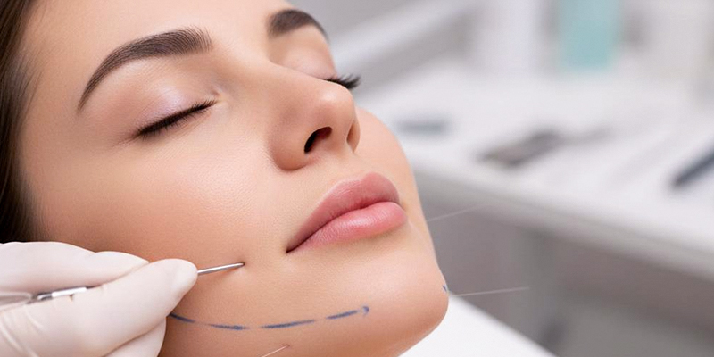 Căng chỉ nâng cơ mặt giá bao nhiêu? Bảng giá theo loại chỉ và khu vực thực hiện 2 Căng chỉ nâng cơ mặt giá bao nhiêu