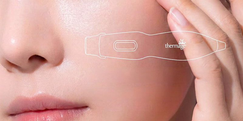 Căng da Thermage là gì? Cơ chế, hiệu quả thực tế và bảng giá mới nhất 2026 1 căng da thermage là gì
