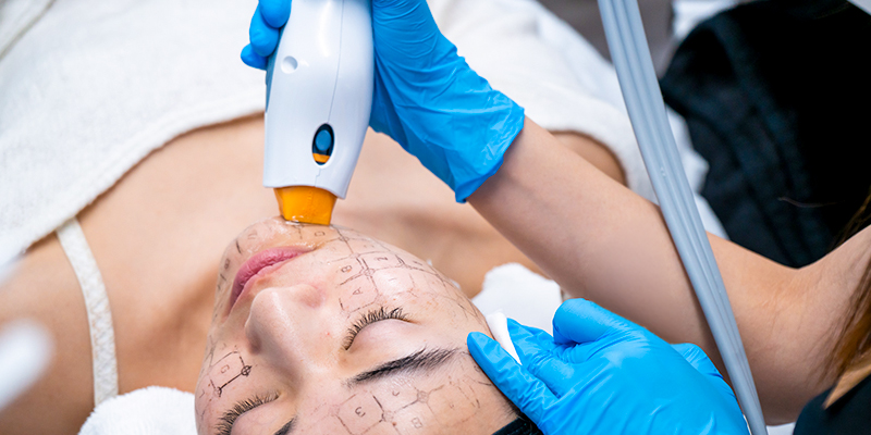 Công nghệ Ultherapy có tốt không? Tác dụng là gì? Ưu nhược điểm cần biết và bảng giá mới nhất hiện nay 4 công nghệ Ultherapy