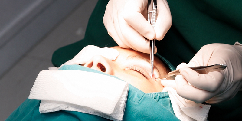 Cosmetic Surgery in Vietnam: Costs, Recovery, and Planning the Trip 2 Cosmetic Surgery in Vietnam