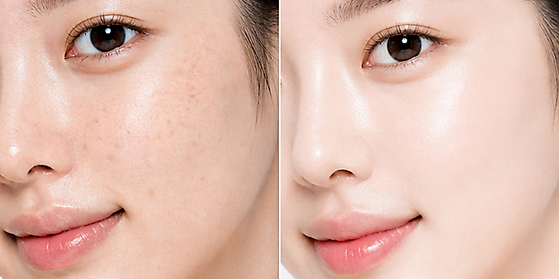 Collagen type 1 là gì, có an toàn không? Tác dụng và hiệu quả khi tiêm trẻ hóa da mặt 2 collagen type 1 co an toan khong 1
