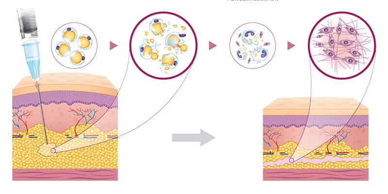 Collagen type 1 là gì, có an toàn không? Tác dụng và hiệu quả khi tiêm trẻ hóa da mặt 3 collagen type 1 co an toan khong 2