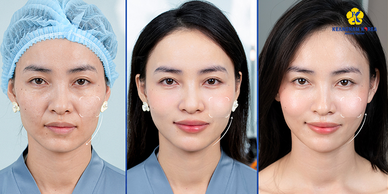 ECM là gì? 4 cấp độ suy giảm nền da tuổi 40 và hướng xử lý cho từng tình trạng 5 ECM là gì