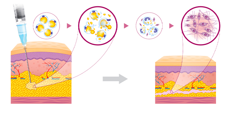So sánh tiêm collagen gân ngựa và collagen cá hồi 3 So sánh tiêm collagen gân ngựa và collagen cá hồi