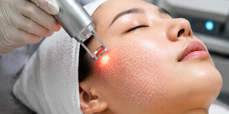 Tiêm collagen trẻ hóa da hay laser tốt hơn? 2 Tiêm collagen trẻ hóa da hay laser tốt hơn?