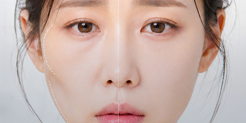 Tiêm collagen trẻ hóa da sau sinh: bao lâu thì tiêm được, chi phí và đối tượng phù hợp 1 Tiêm collagen trẻ hóa da sau sinh