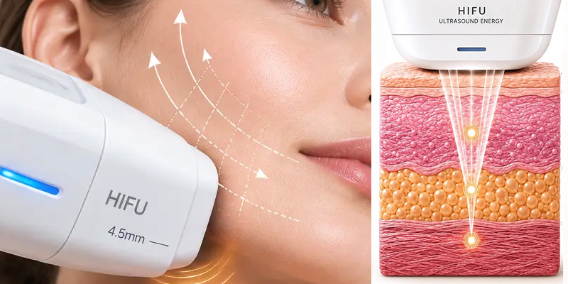 Tiêm collagen và HIFU, phương pháp nào tốt hơn? 2 Tiêm collagen và HIFU phương pháp nào tốt hơn