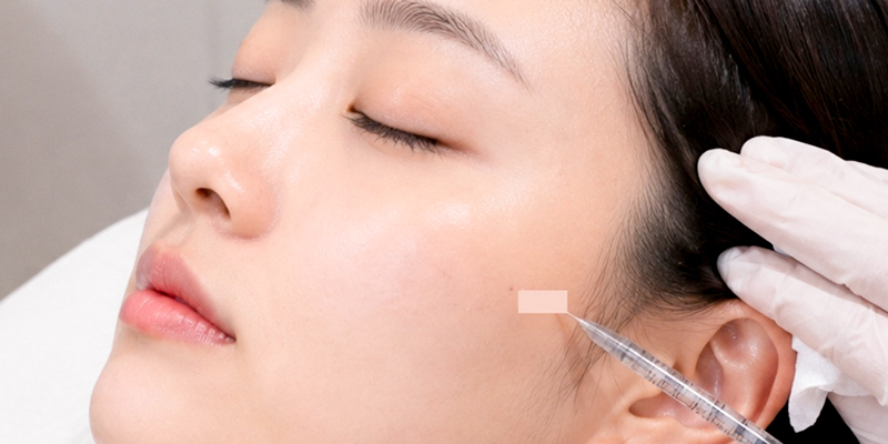 Trẻ hóa da mặt giá bao nhiêu? Bảng giá và dịch vụ mới nhất 2026 2 trẻ hóa da mặt giá bao nhiêu