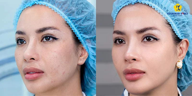 Vì sao Dermazeen được nhiều người quan tâm? 