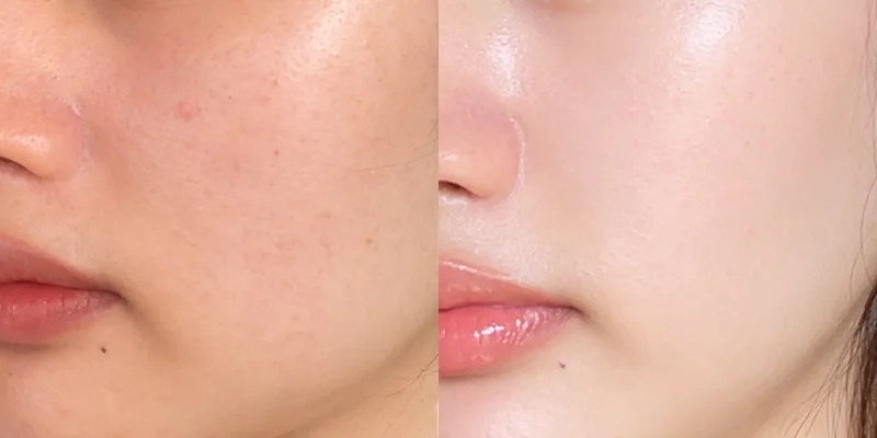 Da xỉn màu, không đều màu và thiếu sức sống