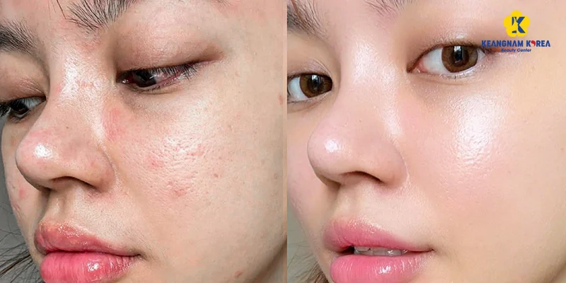 Cách làm da căng bóng ngậm nước rạng rỡ ở tuổi 30 5 Cách làm da căng bóng