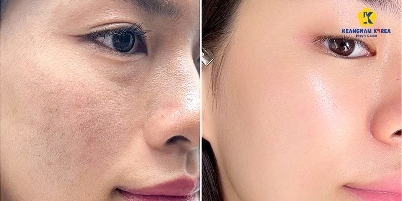 Cách làm da căng bóng ngậm nước rạng rỡ ở tuổi 30 6 Cách làm da căng bóng