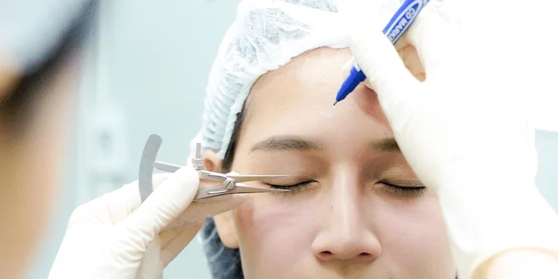 eyelid surgery clinics