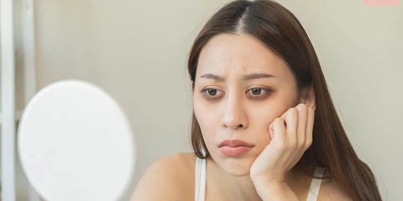 how to get rid of dark circles under eyes

