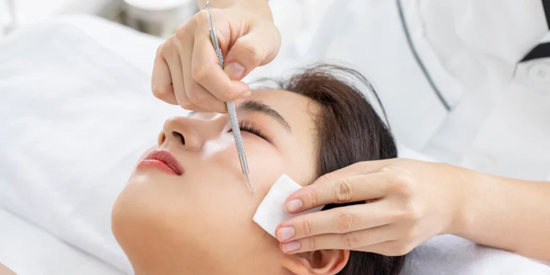 da mụn ẩn có tiêm meso được không