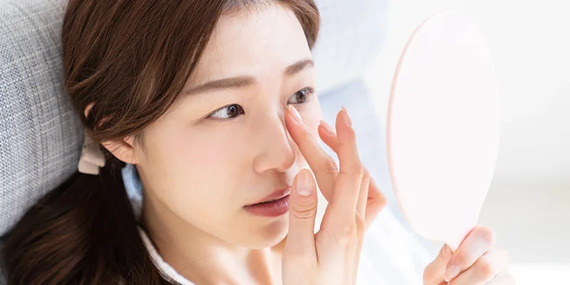nâng mũi bị lệch nhẹ