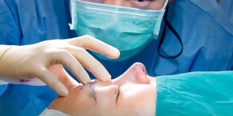 Nâng Mũi Cấu Trúc Có Vĩnh Viễn Không? Dáng Mũi Trông Ra Sao Khi Về Già 3 nâng mũi cấu trúc có vĩnh viễn không