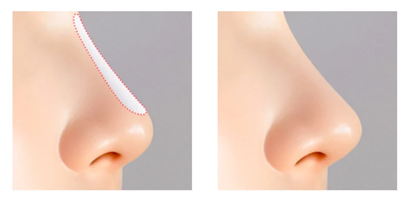 sụn sườn sinh học là gì